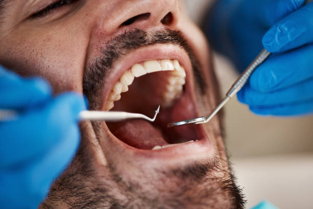 Best Emergency Denture Repair in Gulfport, FL